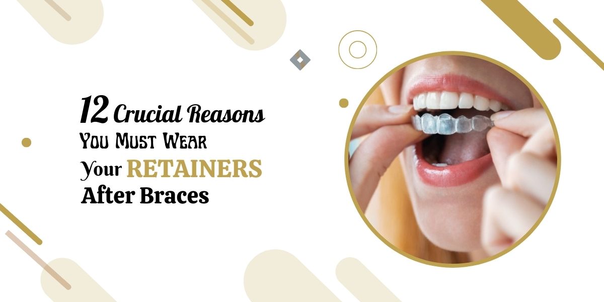 12 Crucial Reasons You Must Wear Your Retainers After Braces